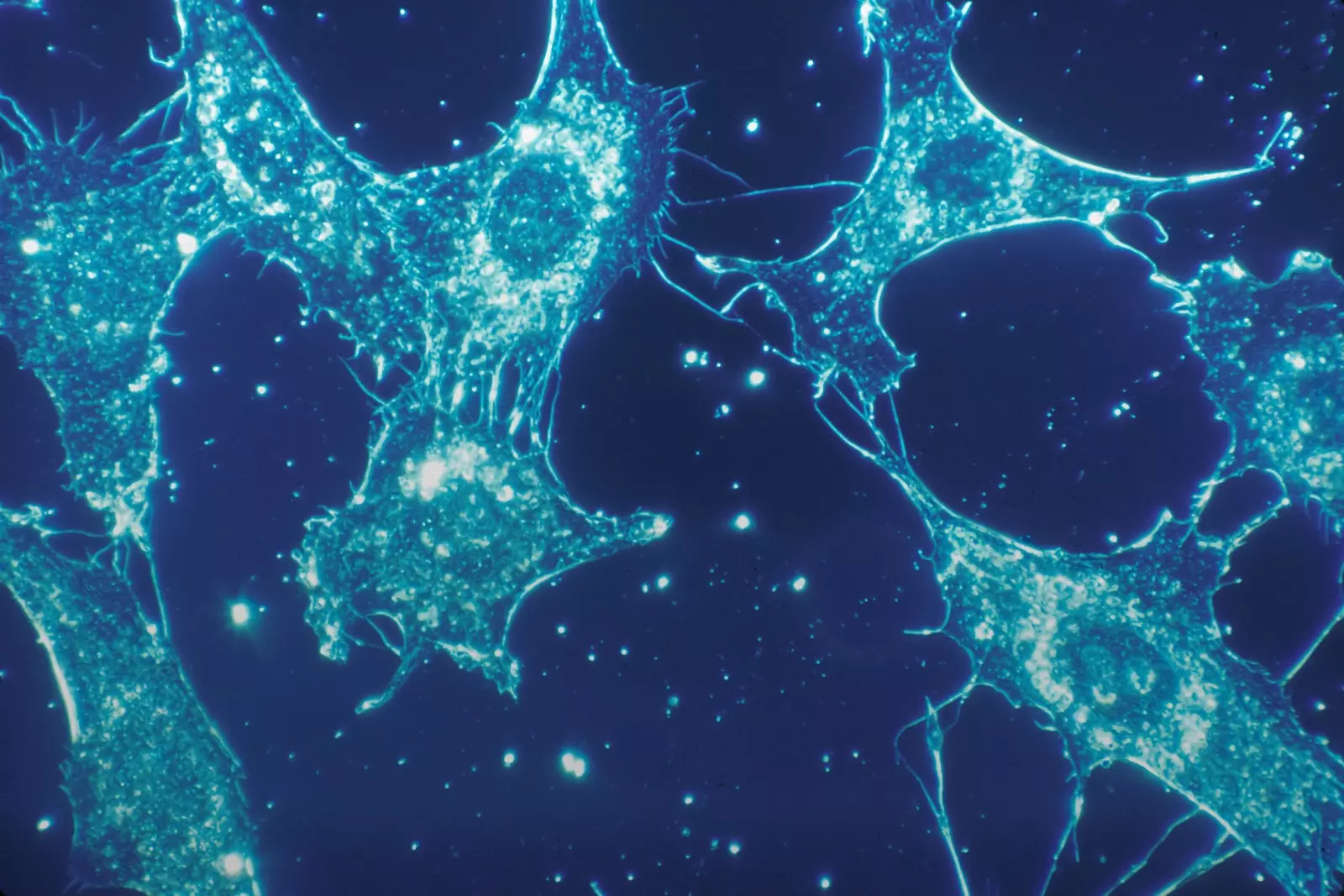 Pandemic Preparedness
